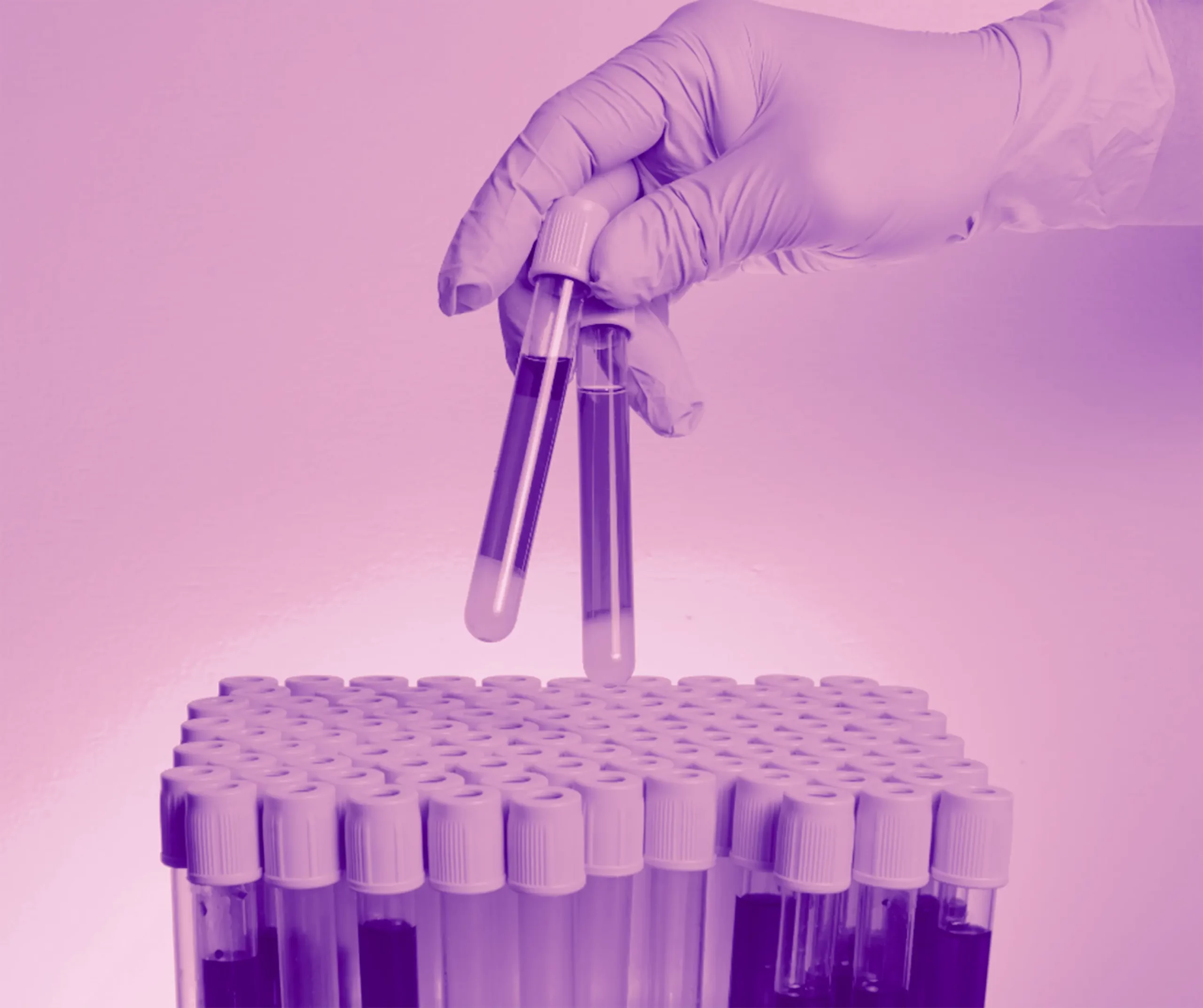 ALL-IN Analyse – Blutanalyse bei der Vitamin Lounge