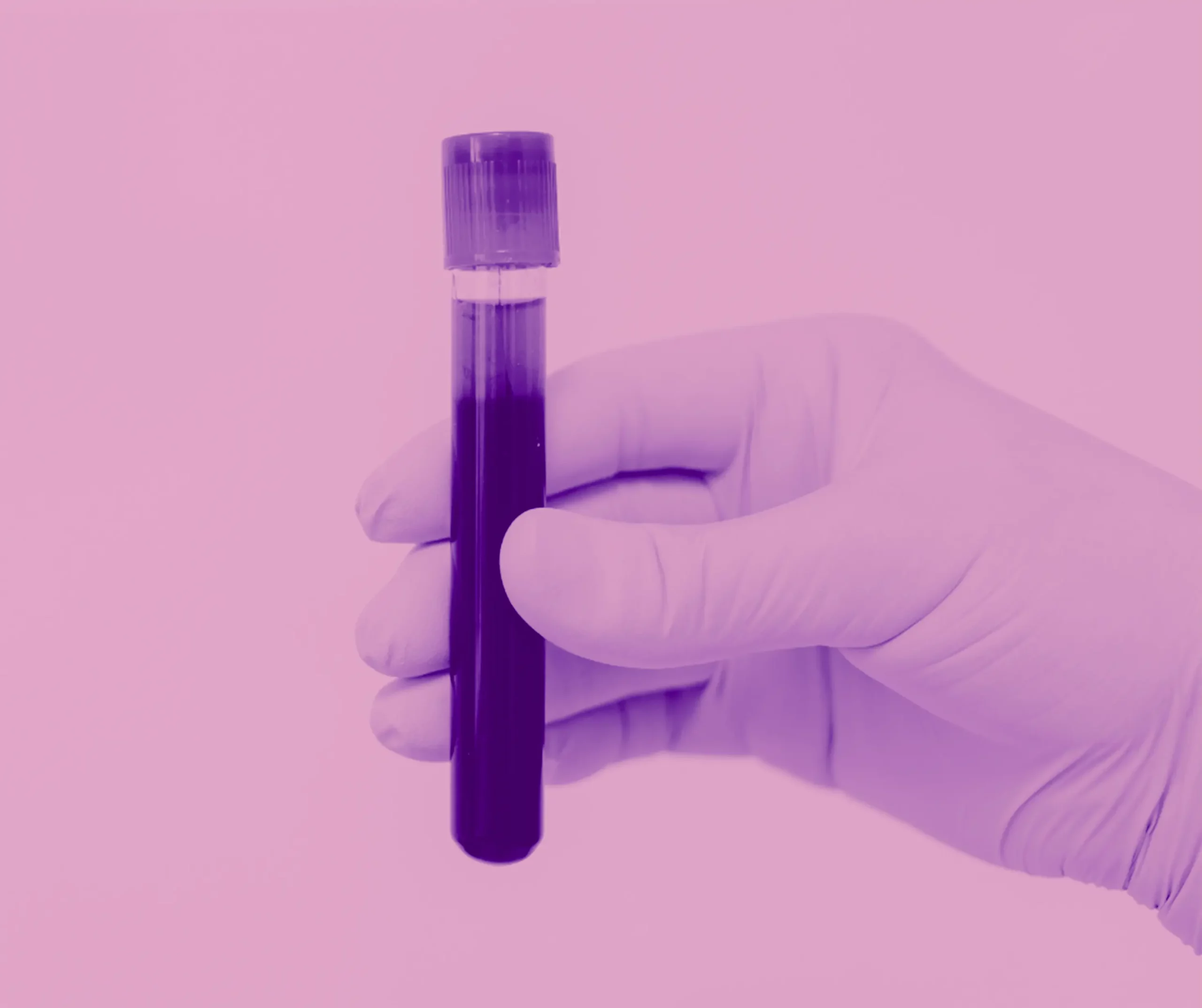 Basis-Analyse – Blutanalyse bei der Vitamin Lounge